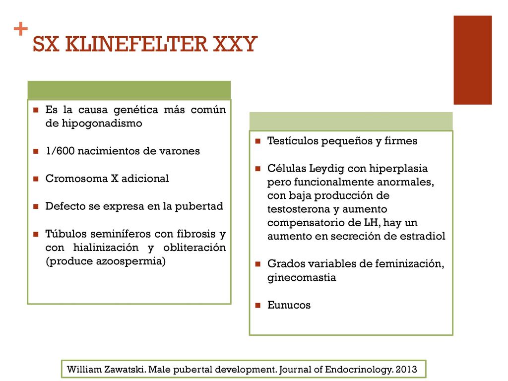 SX KLINEFELTER XXY Es la causa genética más común de hipogonadismo