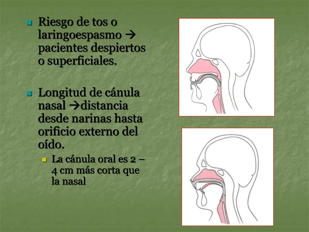 Riesgo de tos o laringoespasmo  pacientes despiertos o superficiales.