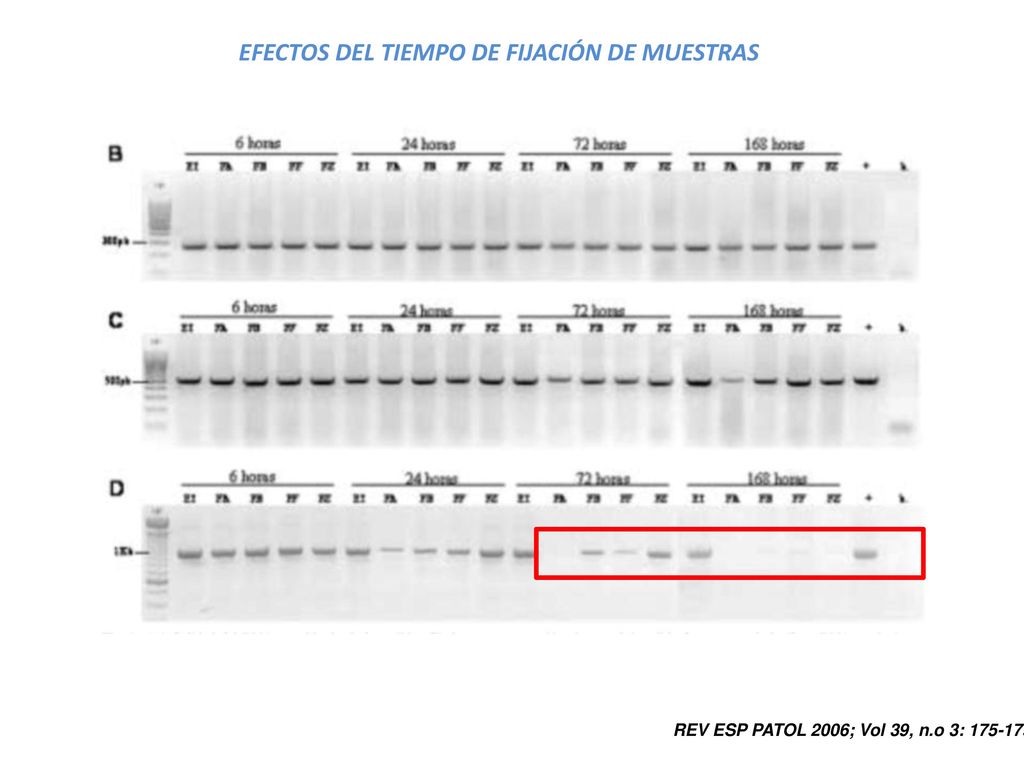 PCR Multiplex • Se da una reacción simultanea de mas de una pareja de primers.