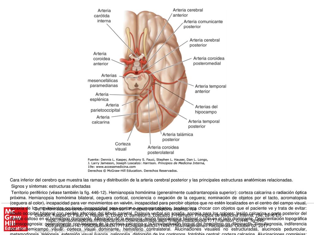 Territorio central. Síndrome talámico: pérdida de sensibilidad (todas las modalidades), dolor y disestesias espontáneos, coreoatetosis, temblor intencional, espasmos de la mano, hemiparesia leve: núcleo posteroventral del tálamo; afección del núcleo subtalámico adyacente o de sus vías aferentes. Síndrome talamoperforante: ataxia cerebelosa cruzada con parálisis ipsolateral del III par (síndrome de Claude): haz dentotalámico y III par correspondiente. Síndrome de Weber: parálisis del tercer par y hemiplejia contralateral: III par craneal y pedúnculo cerebral. Hemiplejia contralateral: pedúnculo cerebral. Parálisis o paresia de los movimientos oculares verticales, desviación oblicua, respuestas pupilares lentas a la luz, miosis y ptosis leves (se puede asociar nistagmo de retracción y cansancio de los párpados): fibras supranucleares para el III par, núcleo intersticial de Cajal, núcleo de Darkschewitsch y comisura posterior. Temblor contralateral rítmico, atáxico y de acción; temblor rítmico postural o de mantenimiento (temblor rúbrico): haz dentotalámico.