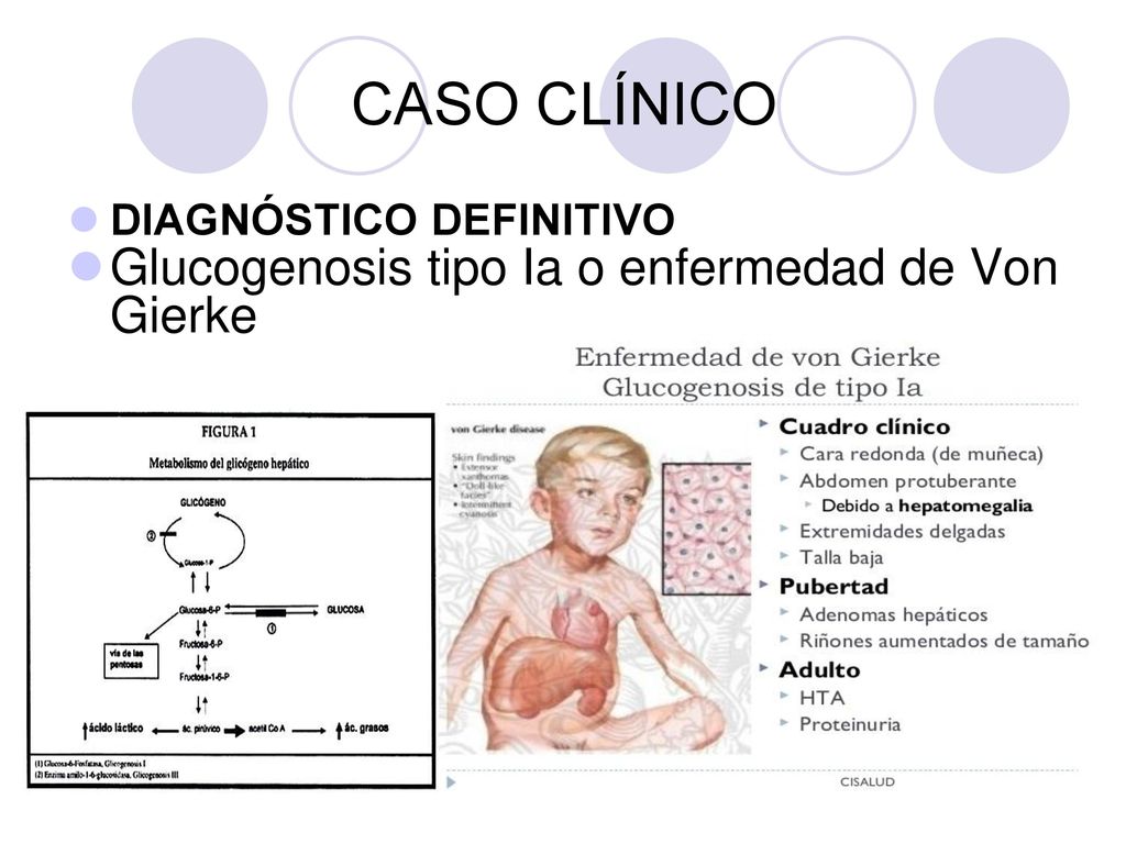 CASO CLÍNICO Glucogenosis tipo Ia o enfermedad de Von Gierke