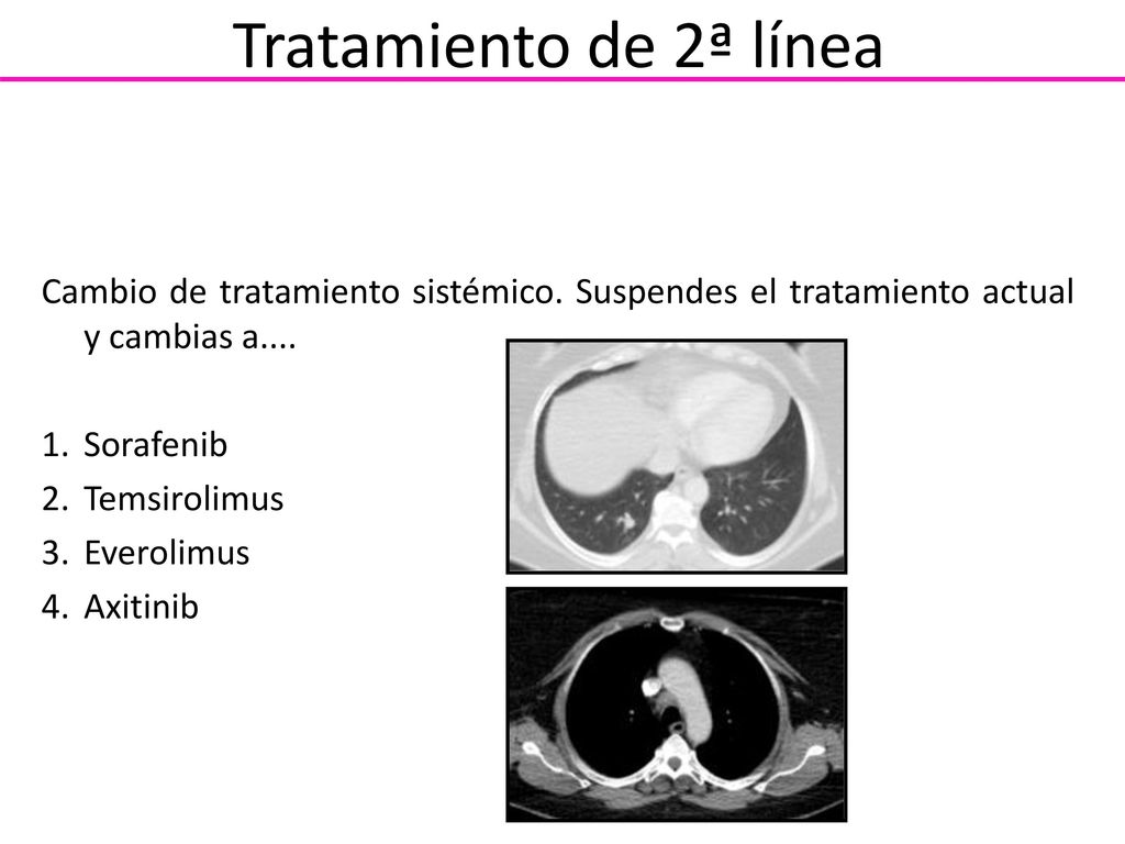 Tratamiento de 2ª línea Cambio de tratamiento sistémico. Suspendes el tratamiento actual y cambias a....
