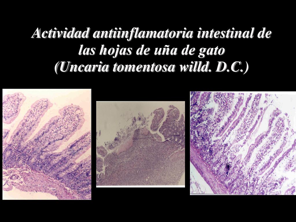Actividad antiinflamatoria intestinal de las hojas de uña de gato (Uncaria tomentosa willd. D.C.)