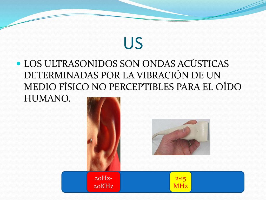 US LOS ULTRASONIDOS SON ONDAS ACÚSTICAS DETERMINADAS POR LA VIBRACIÓN DE UN MEDIO FÍSICO NO PERCEPTIBLES PARA EL OÍDO HUMANO.