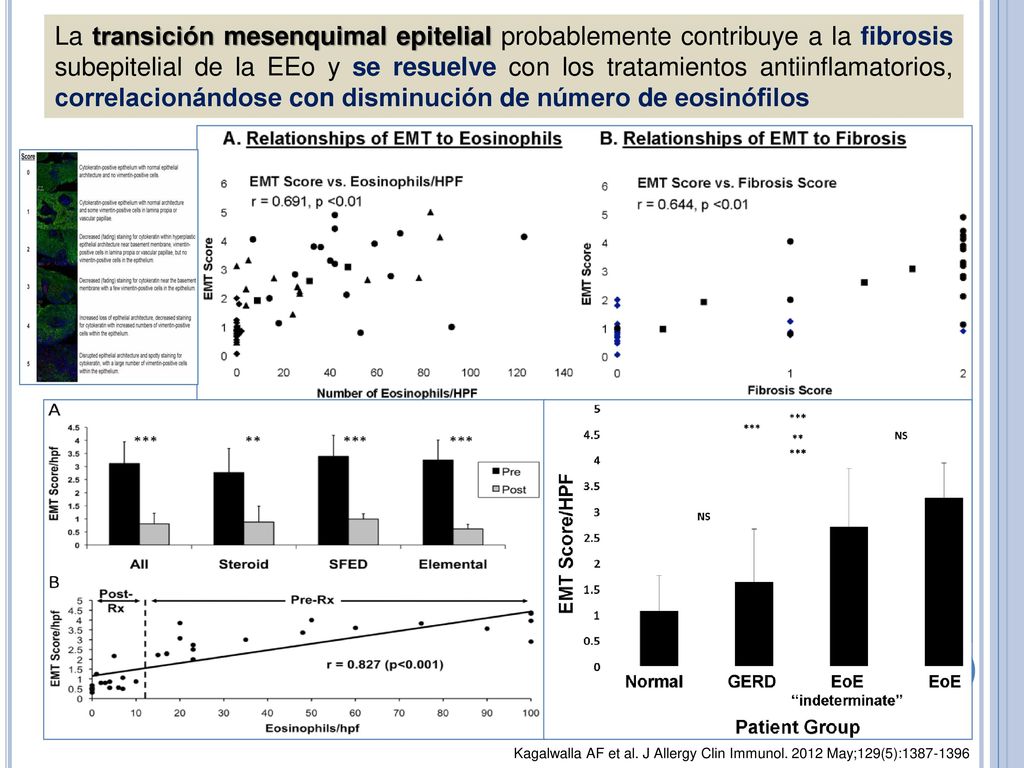 La transición mesenquimal epitelial probablemente contribuye a la fibrosis subepitelial de la EEo y se resuelve con los tratamientos antiinflamatorios, correlacionándose con disminución de número de eosinófilos