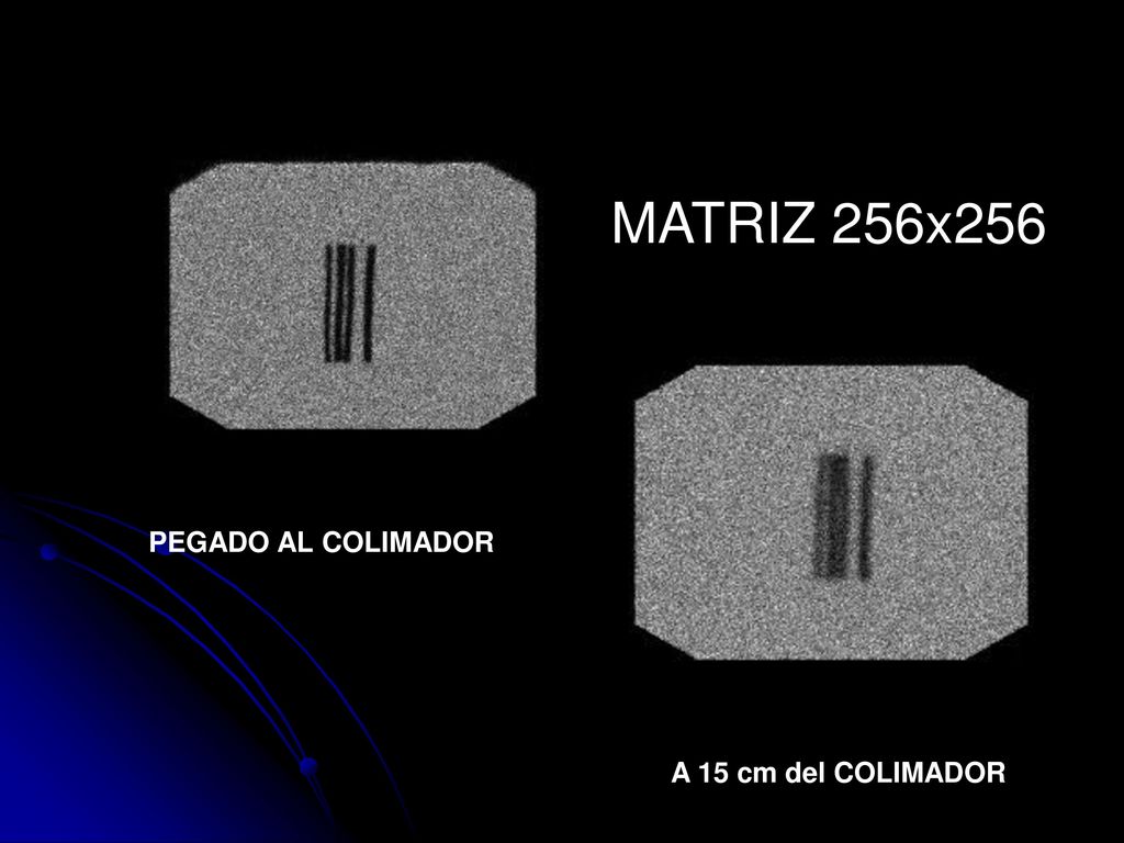 MATRIZ 256x256 PEGADO AL COLIMADOR A 15 cm del COLIMADOR
