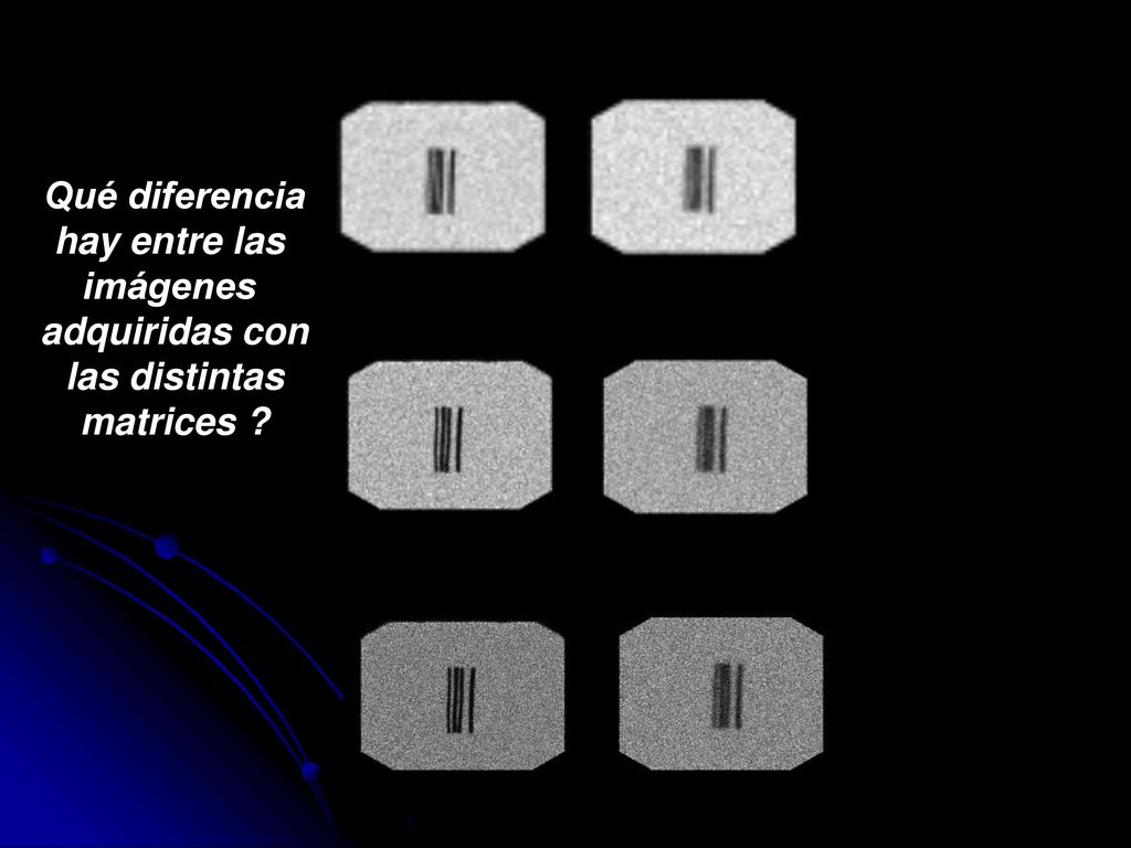 Qué diferencia hay entre las imágenes adquiridas con las distintas matrices