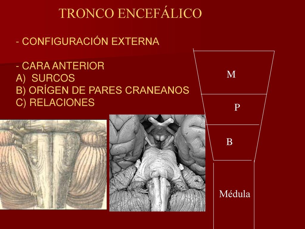 TRONCO ENCEFÁLICO - CONFIGURACIÓN EXTERNA - CARA ANTERIOR A) SURCOS