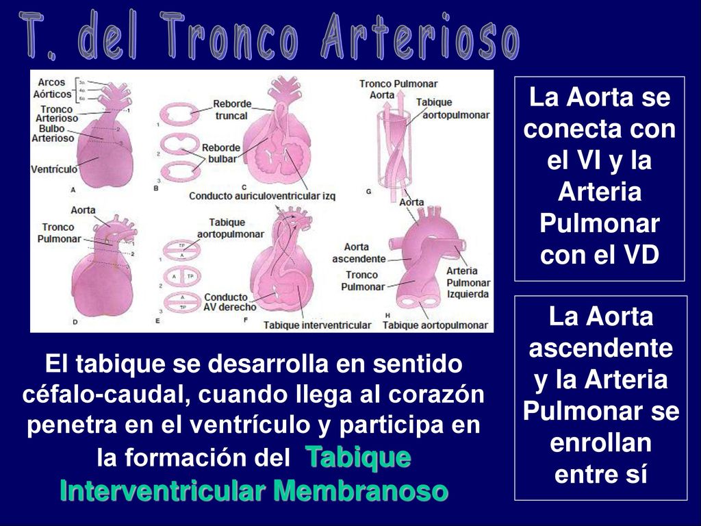 T. del Tronco Arterioso La Aorta se conecta con el VI y la Arteria Pulmonar con el VD.