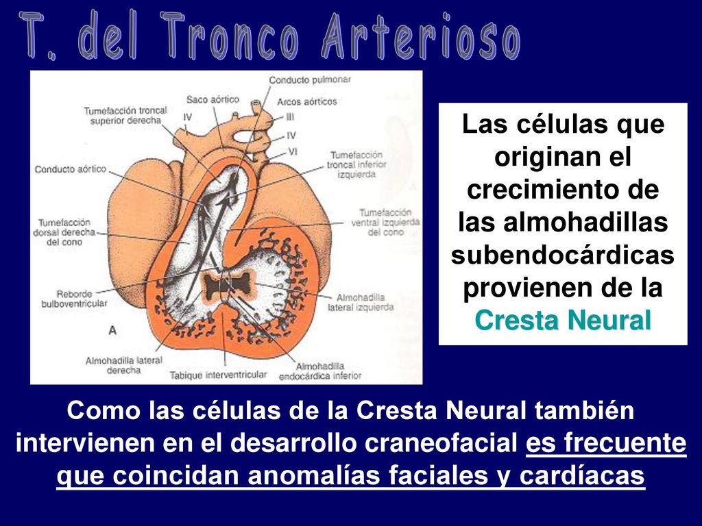 T. del Tronco Arterioso Las células que originan el crecimiento de las almohadillas subendocárdicas provienen de la Cresta Neural.