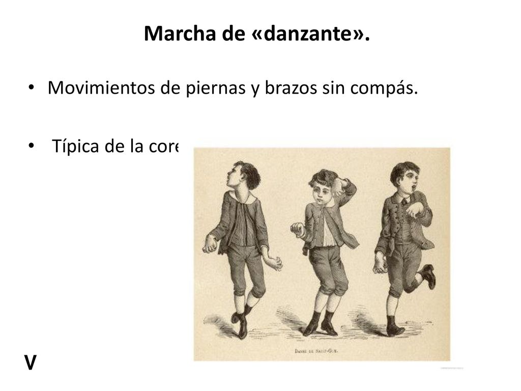 Marcha de «danzante». Movimientos de piernas y brazos sin compás.