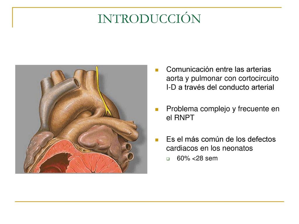 INTRODUCCIÓN Comunicación entre las arterias aorta y pulmonar con cortocircuito I-D a través del conducto arterial.