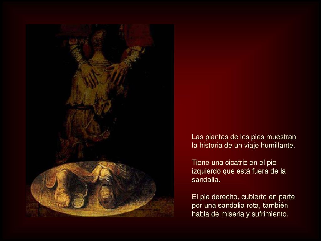 Las plantas de los pies muestran la historia de un viaje humillante.