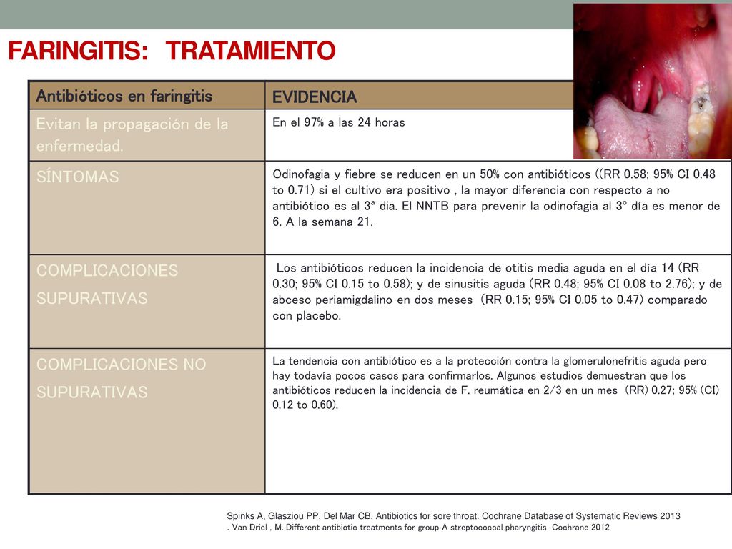 Candidiasis oral CASO CLÍNICO 1 CRITERIOS DE CENTOR Fiebre mayor 38 º