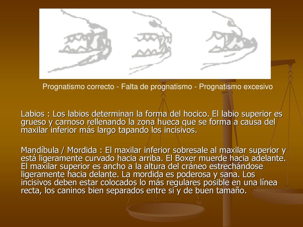 Prognatismo correcto - Falta de prognatismo - Prognatismo excesivo