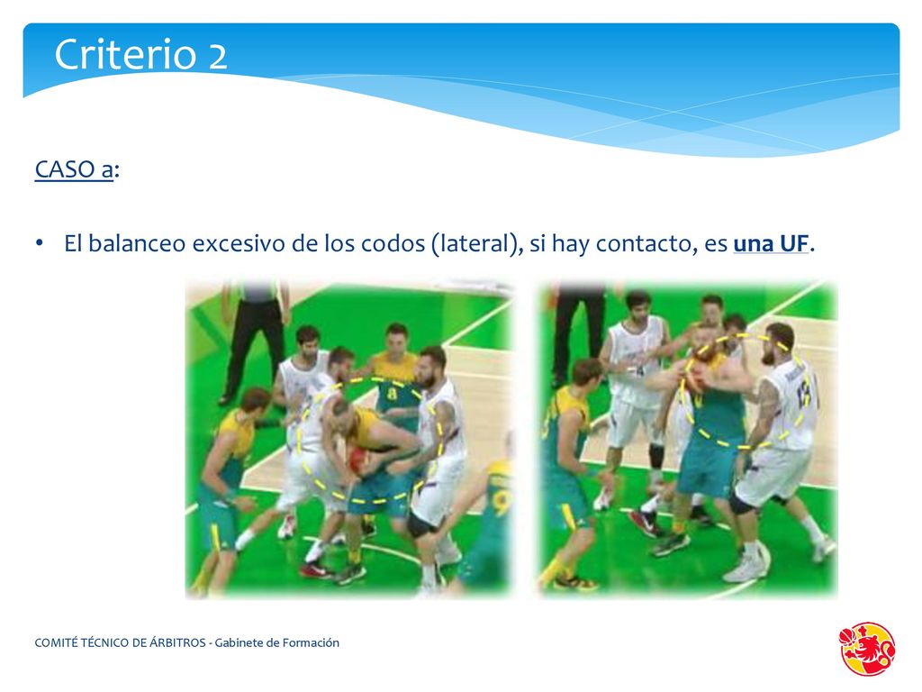 Criterio 2 CASO a: El balanceo excesivo de los codos (lateral), si hay contacto, es una UF.