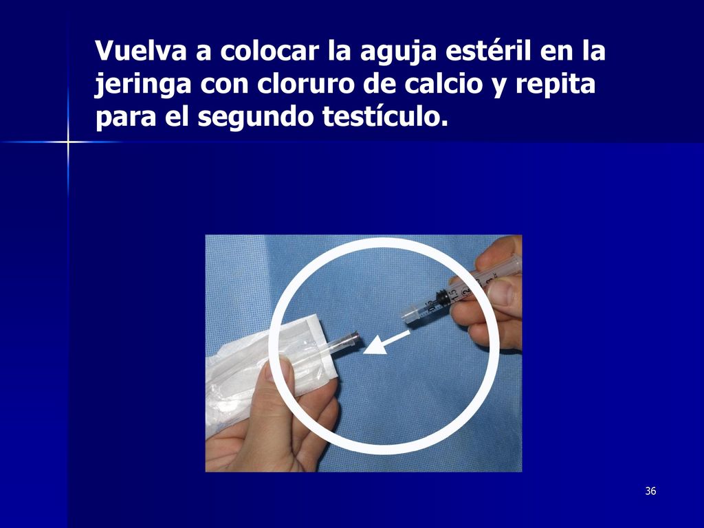 Vuelva a colocar la aguja estéril en la jeringa con cloruro de calcio y repita para el segundo testículo.