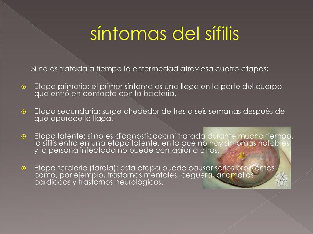 síntomas del sífilis Si no es tratada a tiempo la enfermedad atraviesa cuatro etapas: