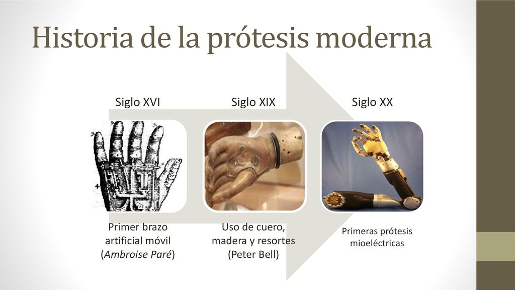 Historia de la prótesis moderna