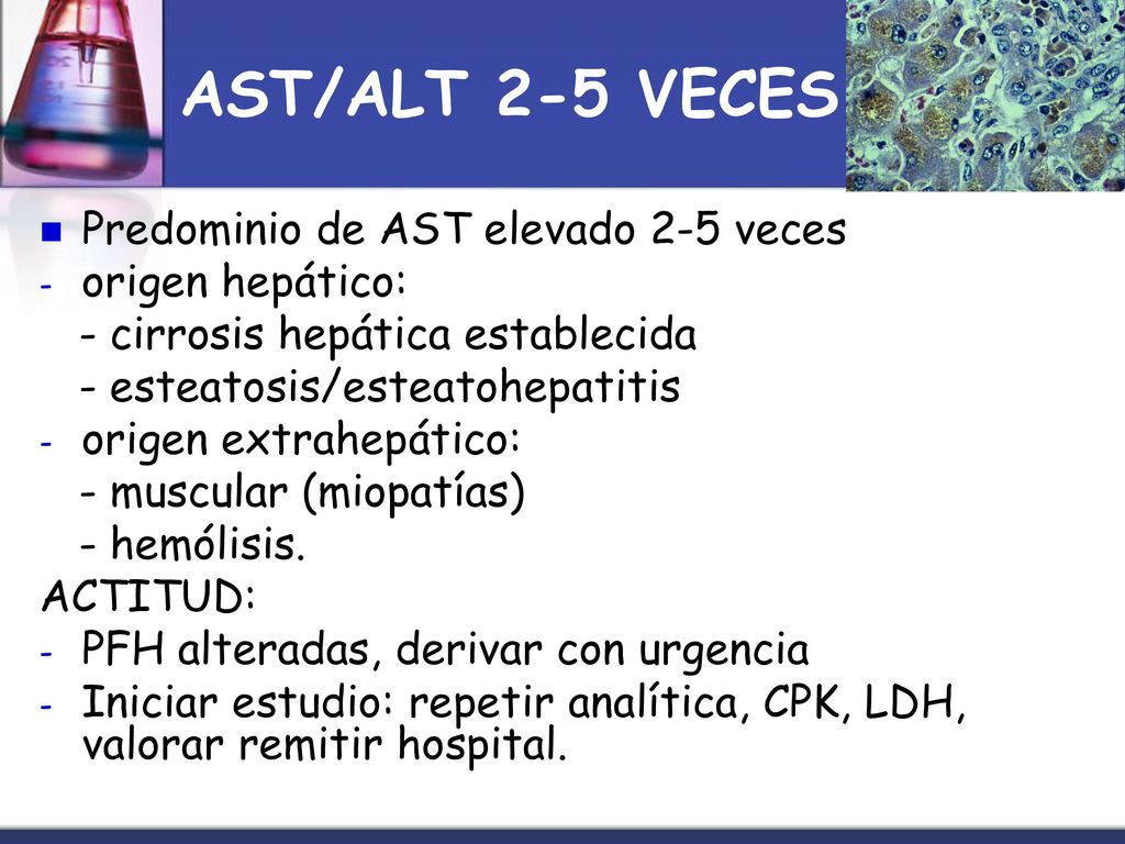 AST/ALT 2-5 VECES Predominio de AST elevado 2-5 veces origen hepático: