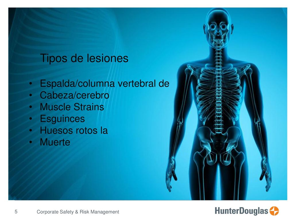 Tipos de lesiones Espalda/columna vertebral de Cabeza/cerebro