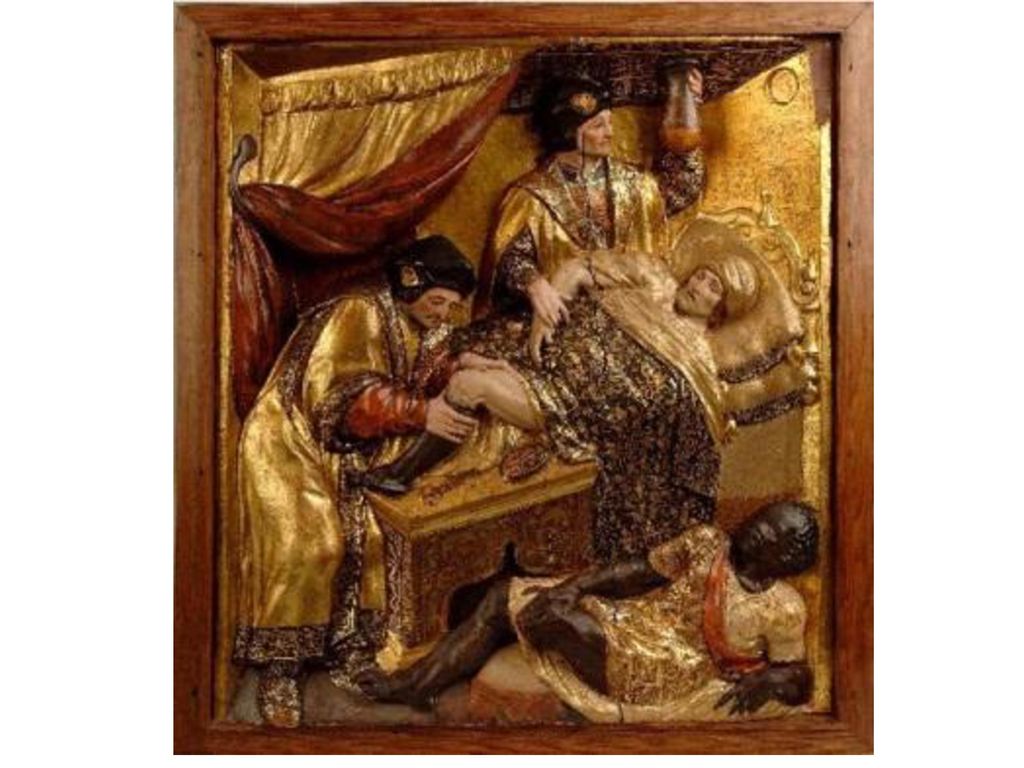 El milagro que unió definitivamente el nombre de San Cosme y San Damián con los trasplantes nos lo relata Jacques de Vorágine (siglo XIII) en su famosísima obra a lo largo de los siglos Leyenda áurea de la vida de los Santos.