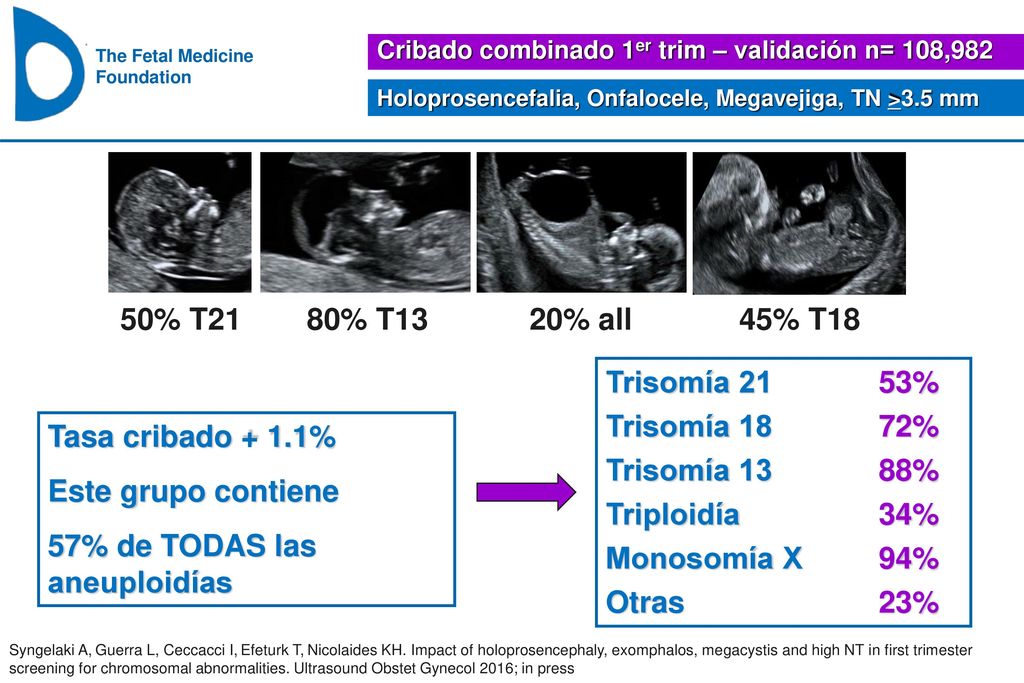 57% de TODAS las aneuploidías Trisomía 21 53% Trisomía 18 72%