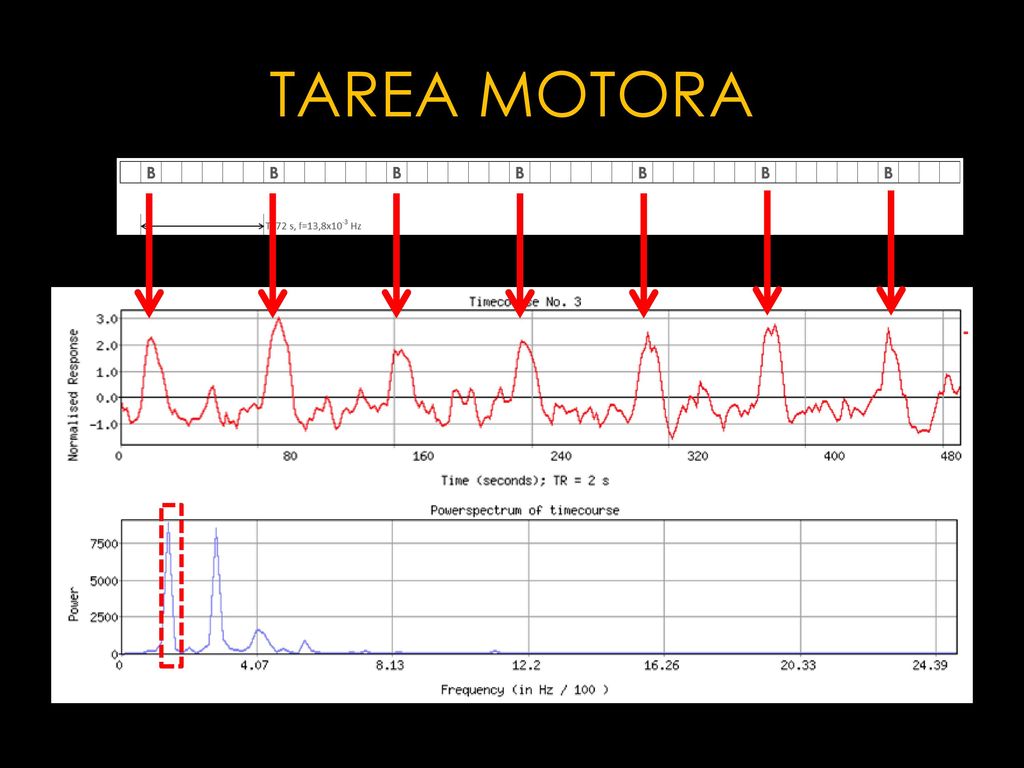 TAREA VISUAL Patrón esperado Corteza lateral occipital.