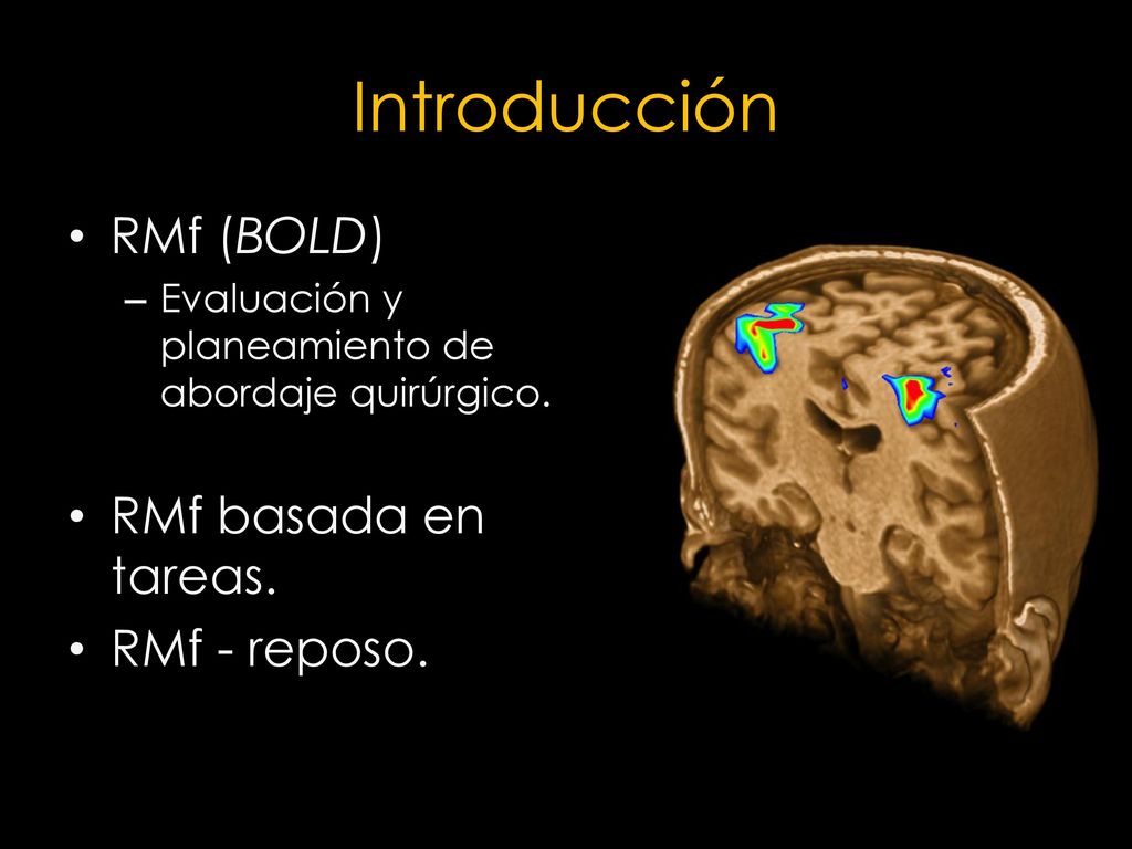 Introducción RMf (BOLD) RMf basada en tareas. RMf - reposo.