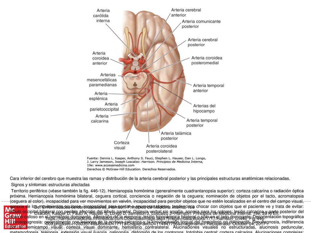 Territorio central. Síndrome talámico: pérdida de sensibilidad (todas las modalidades), dolor y disestesias espontáneos, coreoatetosis, temblor intencional, espasmos de la mano, hemiparesia leve: núcleo posteroventral del tálamo; afección del núcleo subtalámico adyacente o de sus vías aferentes. Síndrome talamoperforante: ataxia cerebelosa cruzada con parálisis ipsolateral del III par (síndrome de Claude): haz dentotalámico y III par correspondiente. Síndrome de Weber: parálisis del tercer par y hemiplejia contralateral: III par craneal y pedúnculo cerebral. Hemiplejia contralateral: pedúnculo cerebral. Parálisis o paresia de los movimientos oculares verticales, desviación oblicua, respuestas pupilares lentas a la luz, miosis y ptosis leves (se puede asociar nistagmo de retracción y cansancio de los párpados): fibras supranucleares para el III par, núcleo intersticial de Cajal, núcleo de Darkschewitsch y comisura posterior. Temblor contralateral rítmico, atáxico y de acción; temblor rítmico postural o de mantenimiento (temblor rúbrico): haz dentotalámico.