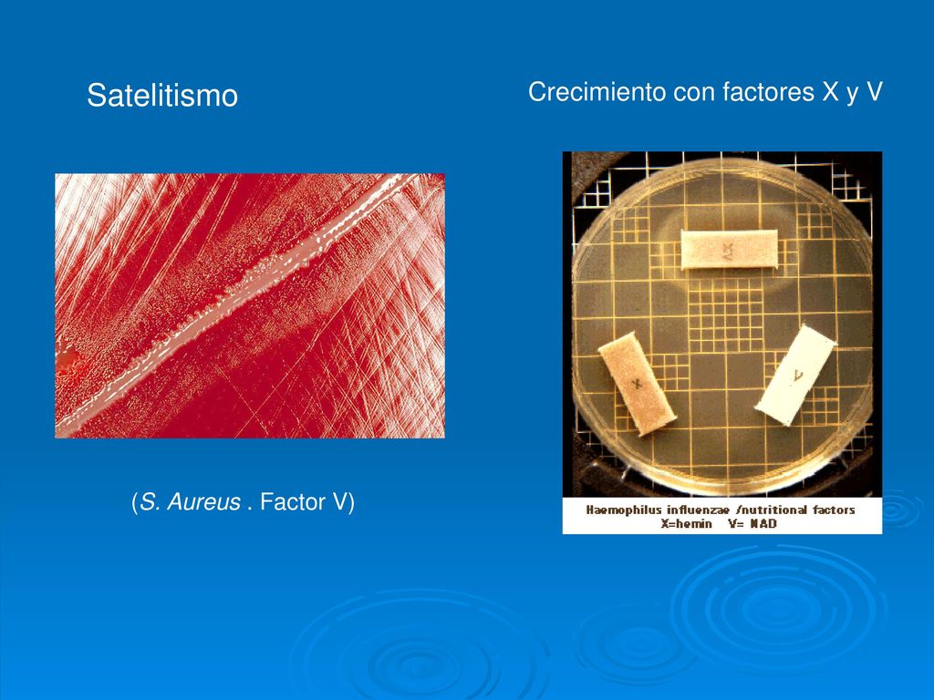 Satelitismo Crecimiento con factores X y V (S. Aureus . Factor V)