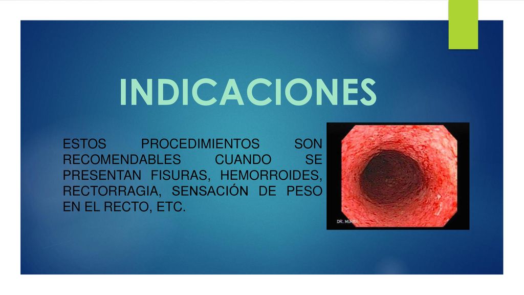 INDICACIONES Estos procedimientos son recomendables cuando se presentan fisuras, hemorroides, rectorragia, sensación de peso en el recto, etc.