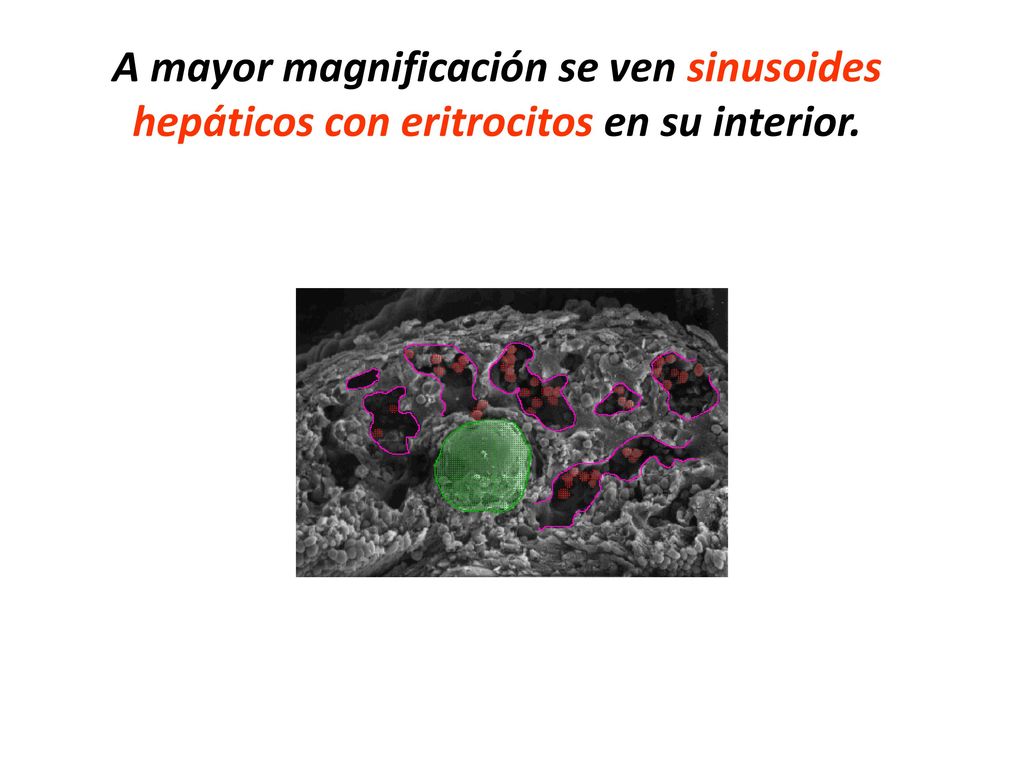 A mayor magnificación se ven sinusoides hepáticos con eritrocitos en su interior.
