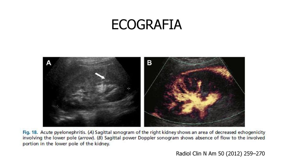 ECOGRAFIA Radiol Clin N Am 50 (2012) 259–270 ECOGRAFIA MUESTRA: