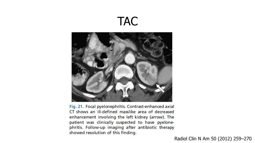 TAC Radiol Clin N Am 50 (2012) 259–270 Estudios de seguimiento: