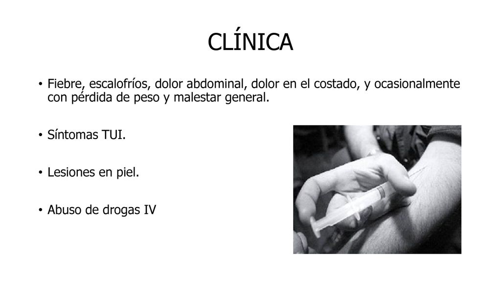 CLÍNICA Fiebre, escalofríos, dolor abdominal, dolor en el costado, y ocasionalmente con pérdida de peso y malestar general.