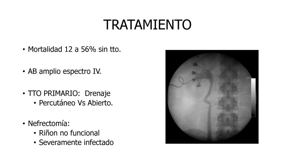TRATAMIENTO Mortalidad 12 a 56% sin tto. AB amplio espectro IV.