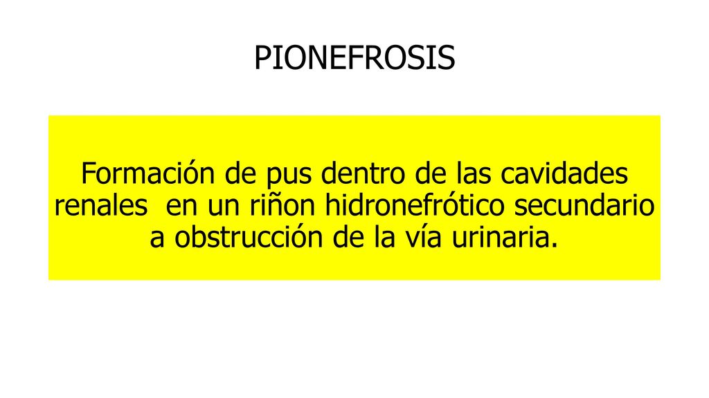 PIONEFROSIS Formación de pus dentro de las cavidades renales en un riñon hidronefrótico secundario a obstrucción de la vía urinaria.