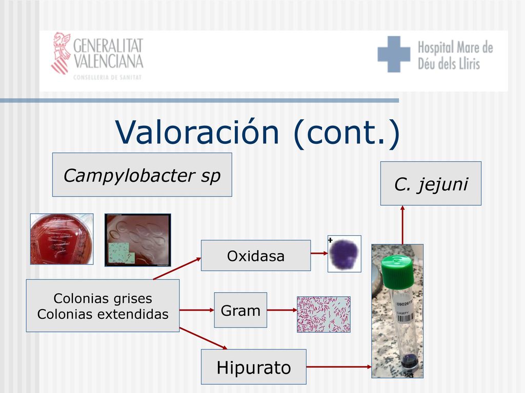 Valoración (cont.) Campylobacter sp C. jejuni Hipurato Oxidasa Gram