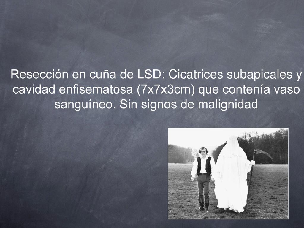 Resección en cuña de LSD: Cicatrices subapicales y cavidad enfisematosa (7x7x3cm) que contenía vaso sanguíneo.