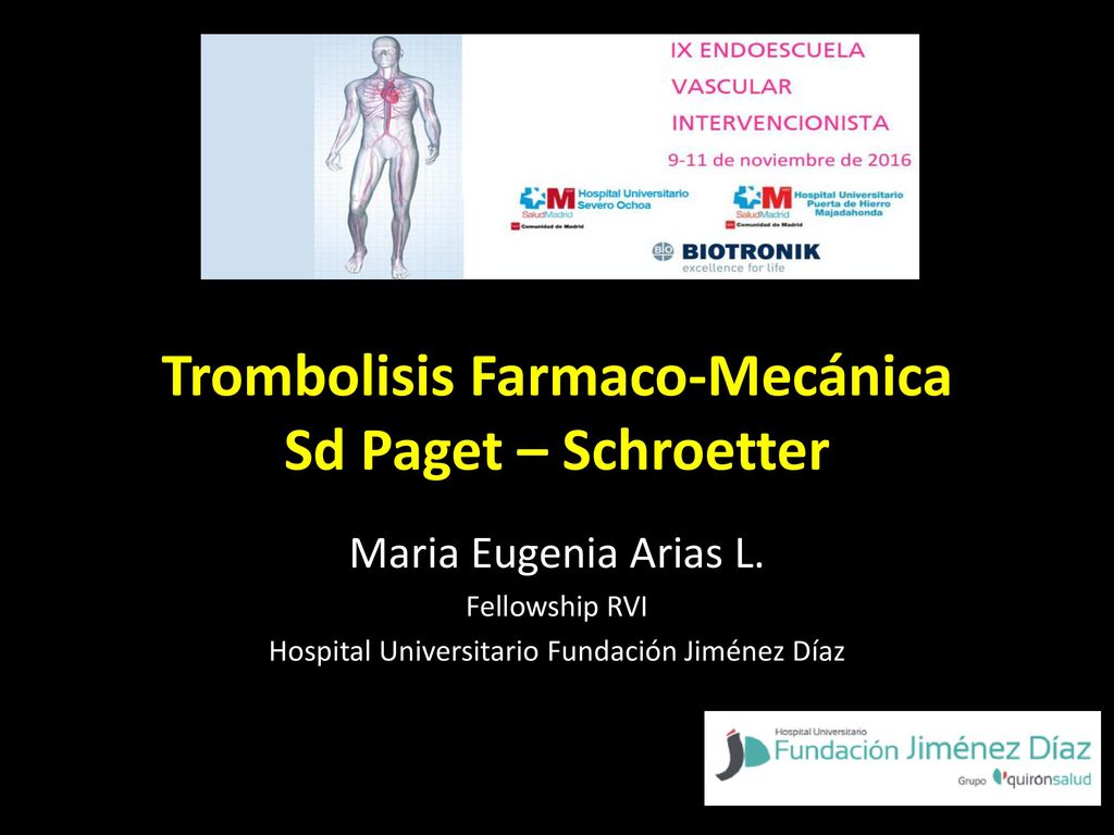 Trombolisis Farmaco-Mecánica Sd Paget – Schroetter