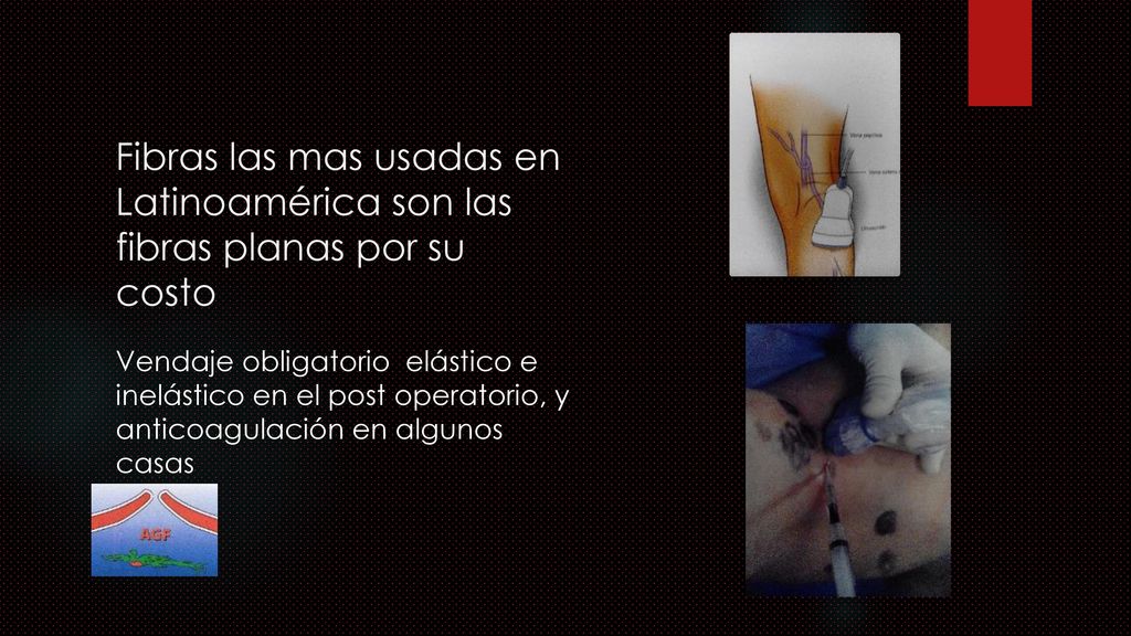 Fibras las mas usadas en Latinoamérica son las fibras planas por su costo