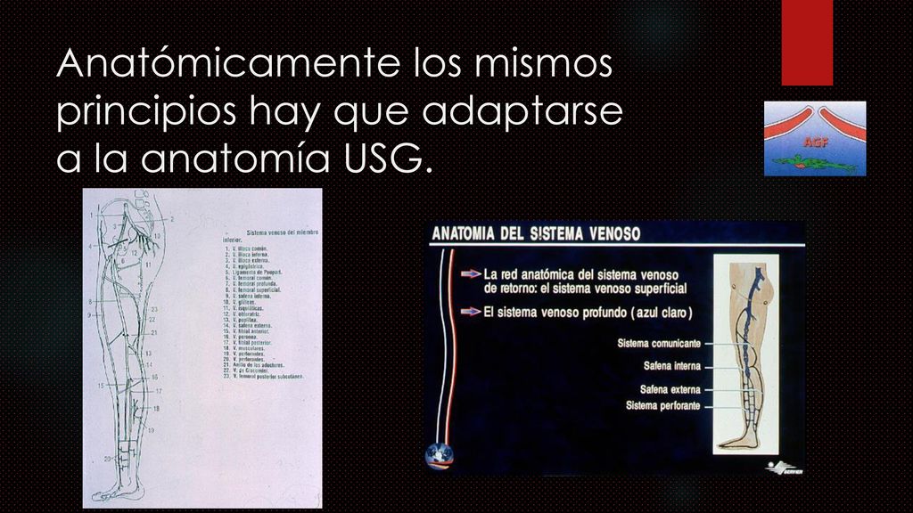 Anatómicamente los mismos principios hay que adaptarse a la anatomía USG.