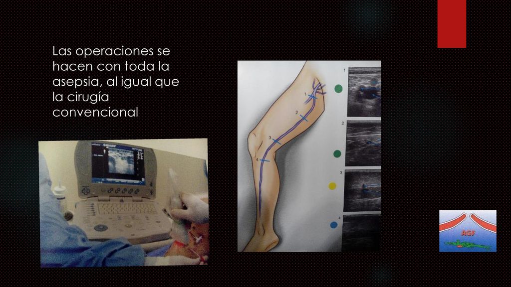 Las operaciones se hacen con toda la asepsia, al igual que la cirugía convencional