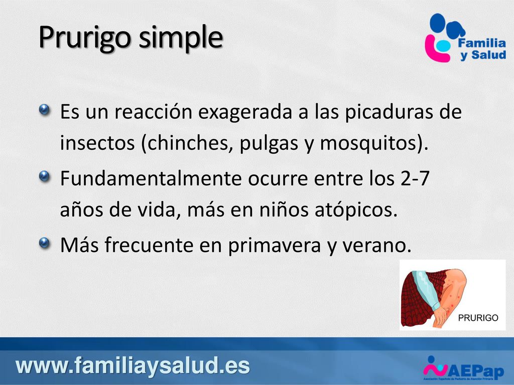 Prurigo simple Es un reacción exagerada a las picaduras de insectos (chinches, pulgas y mosquitos).