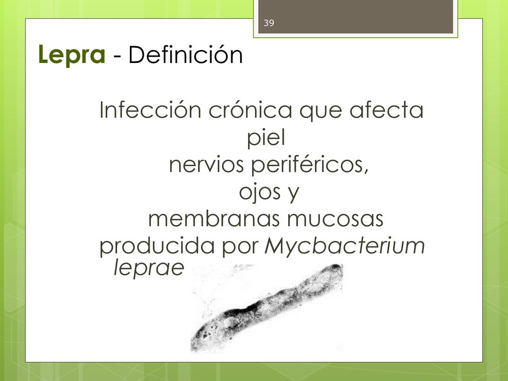 Lepra - Definición Infección crónica que afecta piel nervios periféricos, ojos y membranas mucosas producida por Mycbacterium leprae