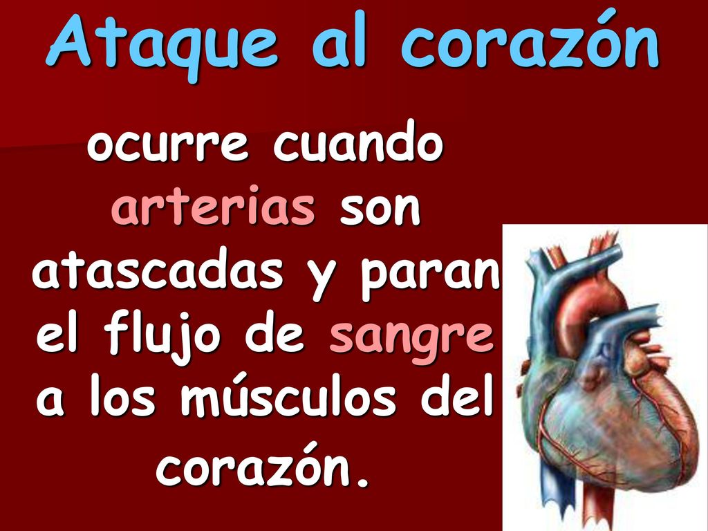 Ataque al corazón ocurre cuando arterias son atascadas y paran el flujo de sangre a los músculos del corazón.
