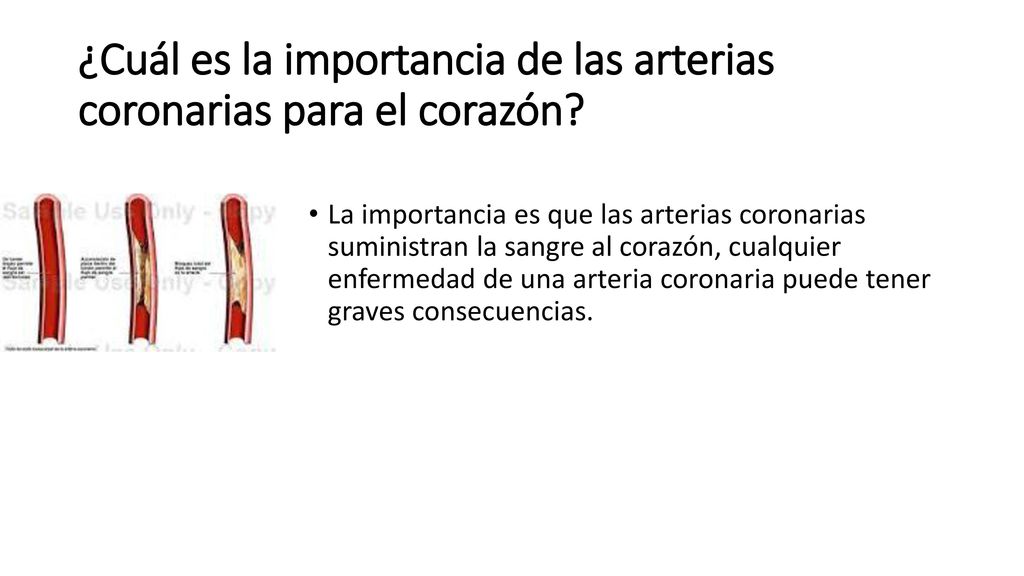 ¿Cuál es la importancia de las arterias coronarias para el corazón