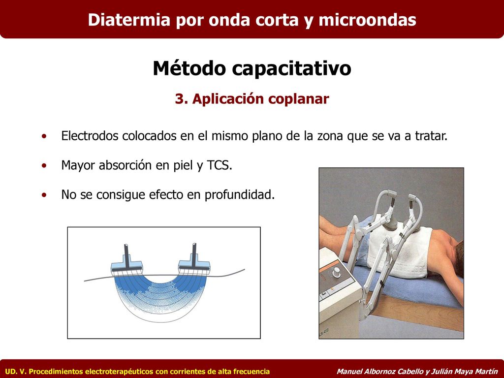 Diatermia por onda corta y microondas