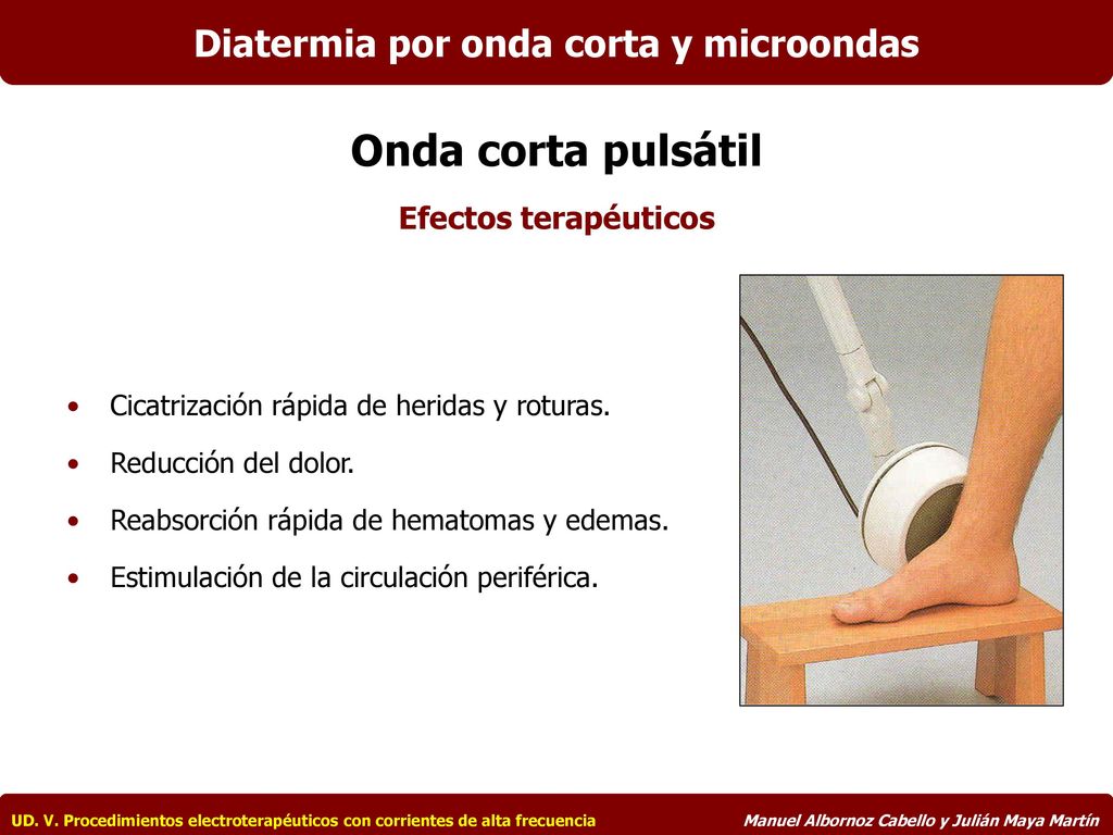 Diatermia por onda corta y microondas